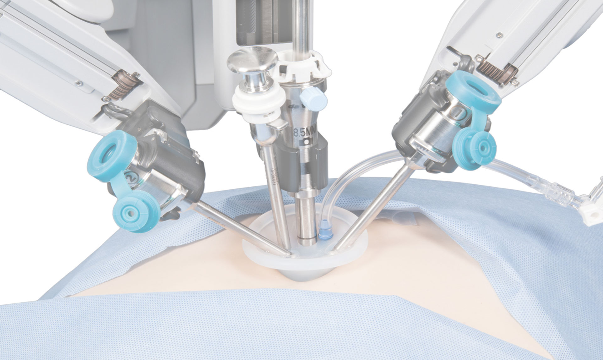 Robotic Laparoscopic Surgery India